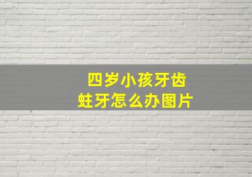 四岁小孩牙齿蛀牙怎么办图片