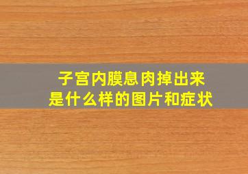 子宫内膜息肉掉出来是什么样的图片和症状