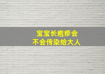 宝宝长疱疹会不会传染给大人