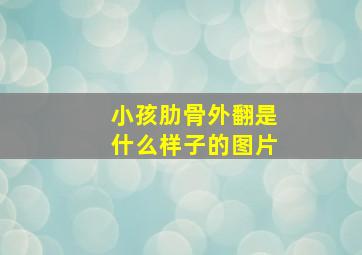 小孩肋骨外翻是什么样子的图片