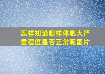 怎样知道腺样体肥大严重程度是否正常呢图片