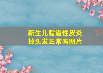 新生儿脂溢性皮炎掉头发正常吗图片