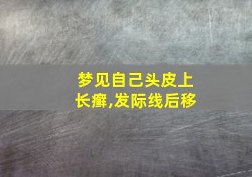 梦见自己头皮上长癣,发际线后移