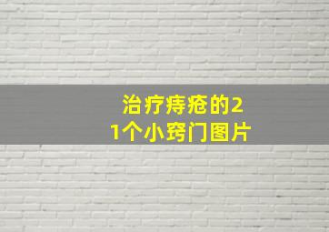 治疗痔疮的21个小窍门图片