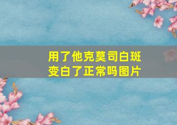 用了他克莫司白斑变白了正常吗图片