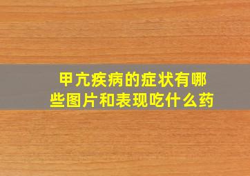 甲亢疾病的症状有哪些图片和表现吃什么药