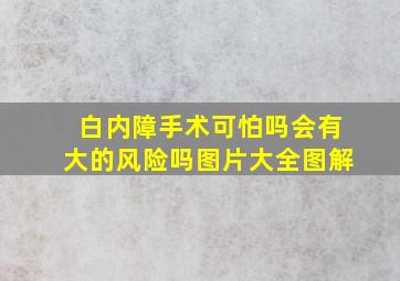 白内障手术可怕吗会有大的风险吗图片大全图解