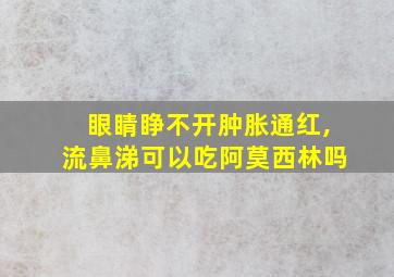 眼睛睁不开肿胀通红,流鼻涕可以吃阿莫西林吗