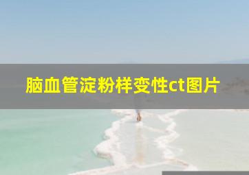 脑血管淀粉样变性ct图片