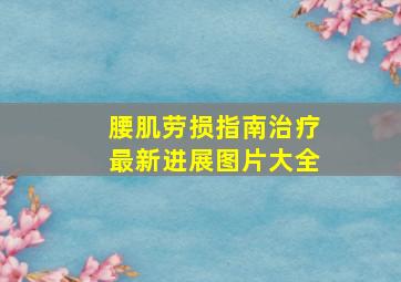 腰肌劳损指南治疗最新进展图片大全