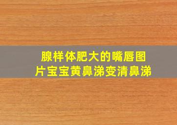 腺样体肥大的嘴唇图片宝宝黄鼻涕变清鼻涕