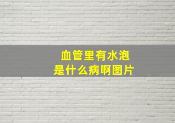 血管里有水泡是什么病啊图片